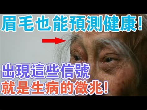 白眉毛可以拔嗎|【白眉毛可以拔嗎】白眉毛突顯外貌問題？拔？留？讓專家來解。